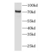 WB analysis of U-937 cells, using FEM1A antibody (1/300 dilution).