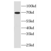 WB analysis of HepG2 cells, using FEM1C antibody (1/1000 dilution).