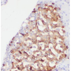 Fermitin Family Homolog 1 (FERMT1) Antibody