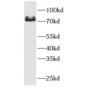 WB analysis of Jurkat cells, using FERMT3 antibody (1/300 dilution).