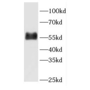 WB analysis of human blood tissue, using fetuin-B antibody (1/2000 dilution).