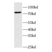 WB analysis of A431 cells, using FGD3 antibody (1/500 dilution).