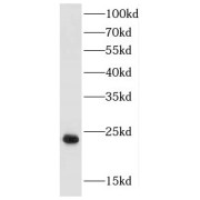 WB analysis of mouse brain tissue, using FGF12 antibody (1/1000 dilution).