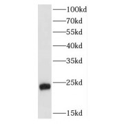 WB analysis of HeLa cells, using FGF8 antibody (1/500 dilution).