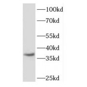 WB analysis of SH-SY5Y cells, using FGFBP2 antibody (1/400 dilution).