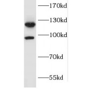 WB analysis of A549 cells, using FGFR2 antibody (1/300 dilution).