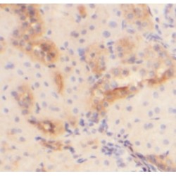 Fibrinogen Like Protein 1 (FGL1) Antibody