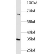 WB analysis of HeLa cells, using FGL1 antibody (1/500 dilution).