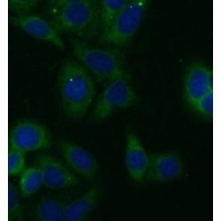 Fumarate Hydratase (FH) Antibody