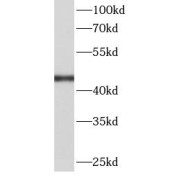 WB analysis of HeLa cells, using FH antibody (1/1000 dilution).