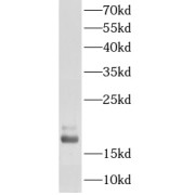 WB analysis of K-562 cells, using FHIT antibody (1/500 dilution).