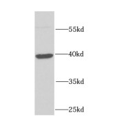 WB analysis of human brain tissue, using FHL1 antibody (1/1000 dilution).