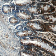 IHC-P analysis of human colon tissue, using FIBCD1 Antibody (1/100 dilution).