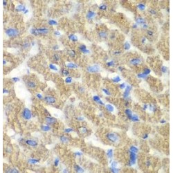 Acidic Fibroblast Growth Factor Intracellular-Binding Protein (FIBP) Antibody