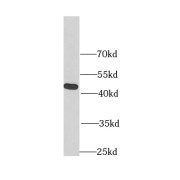 WB analysis of BxPC-3 cells, using FIBP antibody (1/1000 dilution).