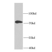 WB analysis of human kidney tissue, using FN1 antibody (1/250 dilution).