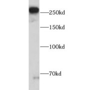 WB analysis of U-87MG cells, using FN1 antibody (1/2000 dilution).