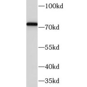 WB analysis of mouse heart tissue, using Fibulin-1 antibody (1/1000 dilution).