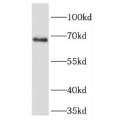 WB analysis of HeLa cells, using FIGNL1 antibody (1/1500 dilution).