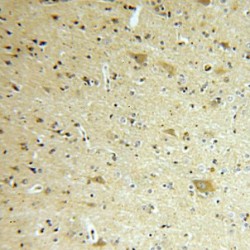 Fission 1 (FIS1) Antibody
