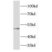 WB analysis of fetal human brain tissue, using FJX1 antibody (1/300 dilution).