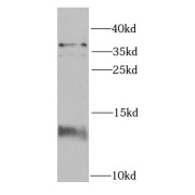 WB analysis of mouse brain tissue, using FKBP1A antibody (1/1000 dilution).