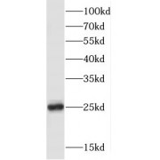 WB analysis of PC-3 cells, using FKBP3 antibody (1/1000 dilution).