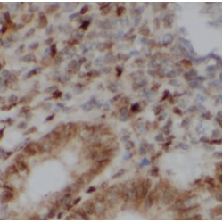 FK506 Binding Protein 5 (FKBP5) Antibody