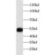 WB analysis of K-562 cells, using FKBP5 antibody (1/1000 dilution).