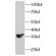 WB analysis of human testis tissue, using FKBP6 antibody (1/300 dilution).