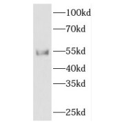 WB analysis of Jurkat cells, using FKBP8 antibody (1/500 dilution).