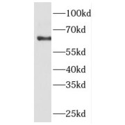 WB analysis of NIH/3T3 cells, using FKBP9 antibody (1/600 dilution).