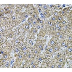 Filamin-B (FLNB) Antibody