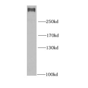 WB analysis of HeLa cells, using FLNB antibody (1/1000 dilution).