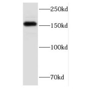 WB analysis of HeLa cells, using FMNL1 antibody (1/300 dilution).