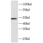 WB analysis of mouse lung tissue, using FMO2 antibody (1/800 dilution).