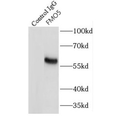 Flavin Containing Monooxygenase 5 (FMO5) Antibody