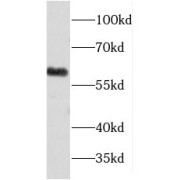 WB analysis of human liver tissue, using FMO5 antibody (1/1200 dilution).