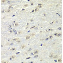 Fragile X Mental Retardation 1 (FMR1) Antibody