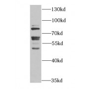 WB analysis of K-562 cells, using FMR1 antibody (1/1000 dilution).