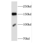 WB analysis of Jurkat cells, using FNDC3B antibody (1/2000 dilution).