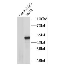 Farnesyltransferase Beta (FNTB) Antibody