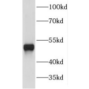 WB analysis of HeLa cells, using FNTB antibody (1/500 dilution).