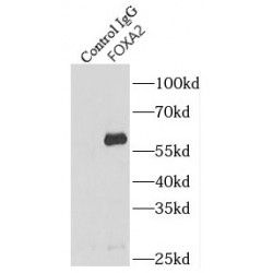 Forkhead Box Protein A2 (FOXA2) Antibody