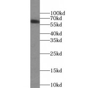 WB analysis of HepG2 cells, using FOXA2 antibody (1/1000 dilution).