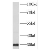 WB analysis of HepG2 cells, using FOXB1 antibody (1/300 dilution).