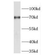 WB analysis of MCF-7 cells, using FOXC1 antibody (1/300 dilution).