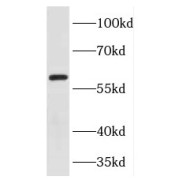 WB analysis of mouse testis tissue, using FOXG1 antibody (1/500 dilution).