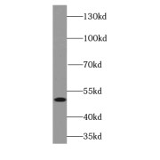 WB analysis of mouse ovary tissue, using FOXL2-Specific antibody (1/300 dilution).