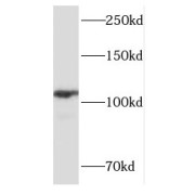 WB analysis of mouse thymus tissue, using FOXM1 antibody (1/1000 dilution).